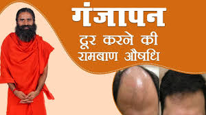 गंजापन ( Baldness) दूर करने की रामबाण औषधि | Swami Ramdev - YouTube
